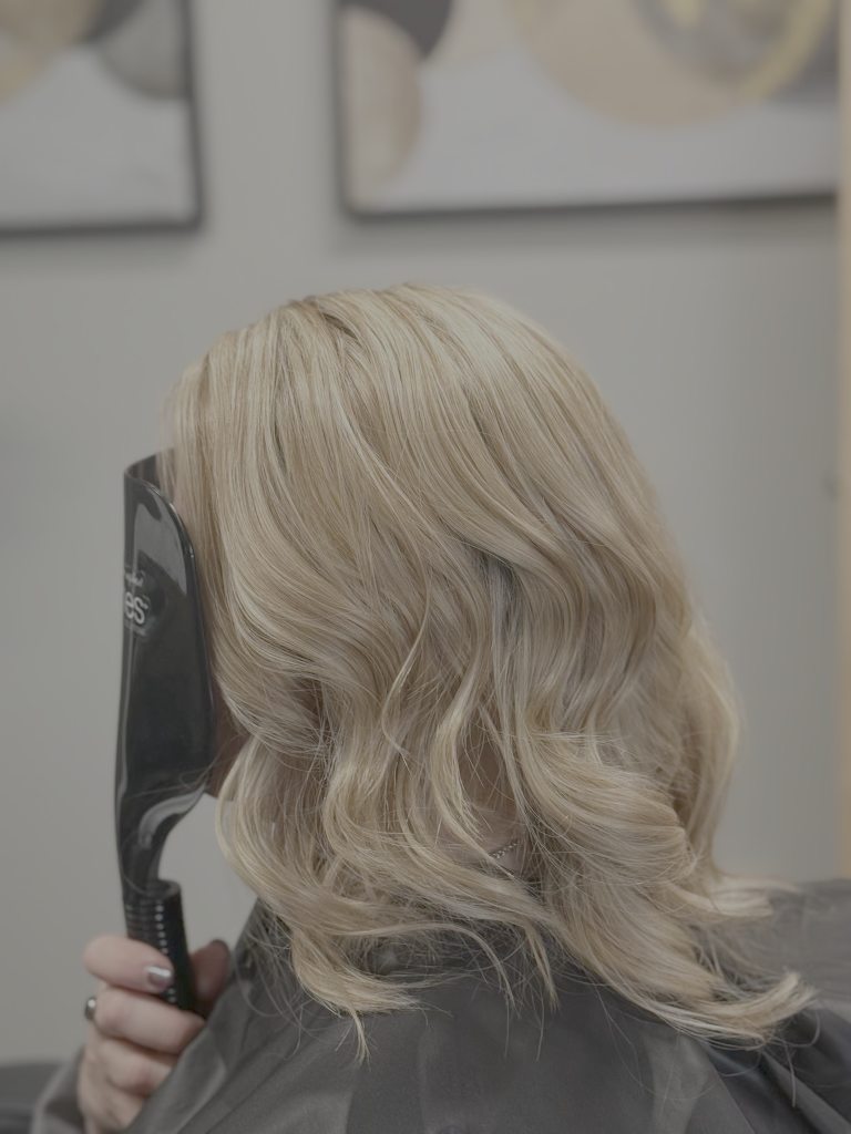 Before hair restoration 3
