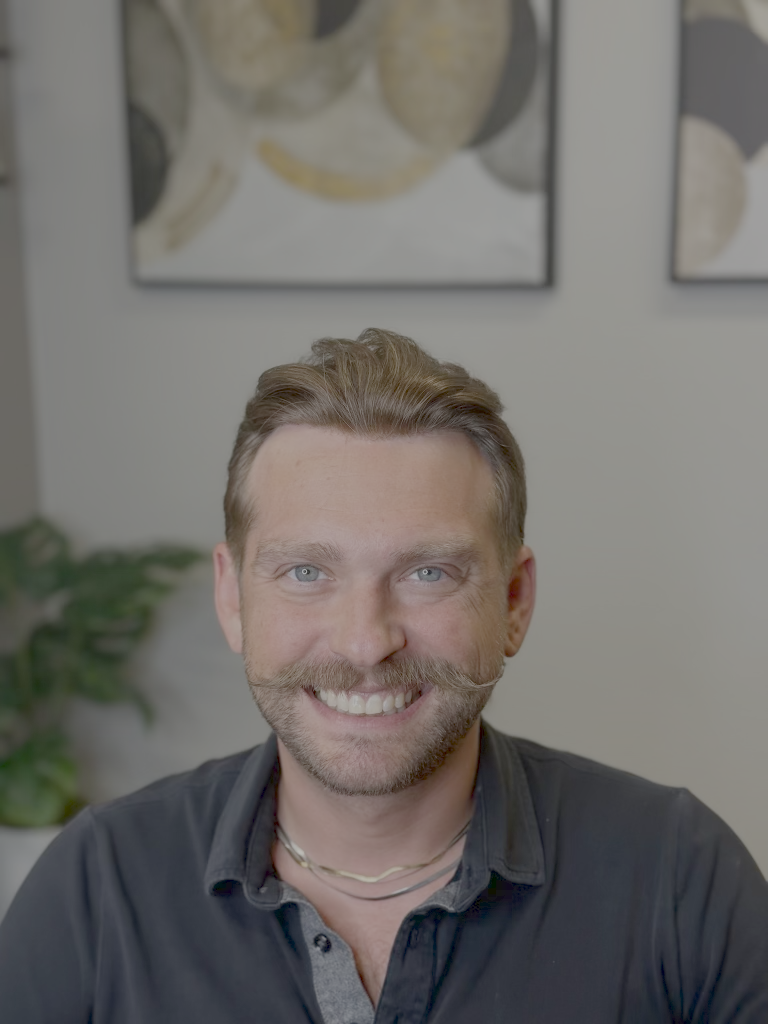 After hair restoration 2